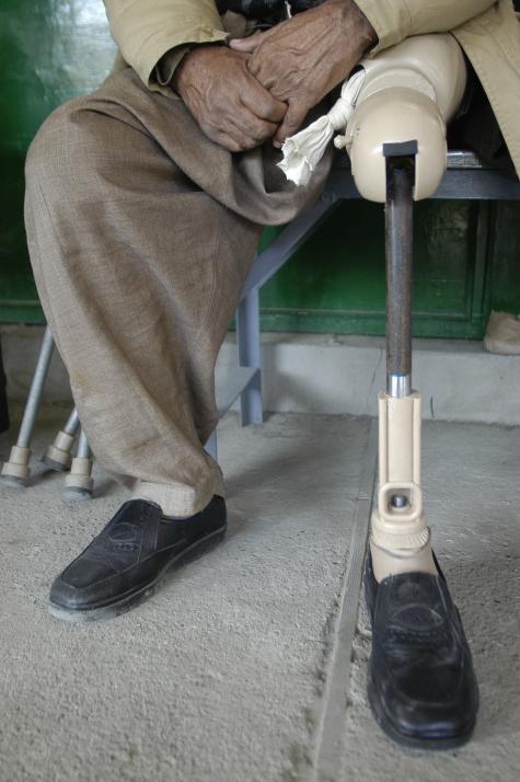 Image of the lower half of a man who has lost his leg due to a landmine, he is wearing a prosthetic